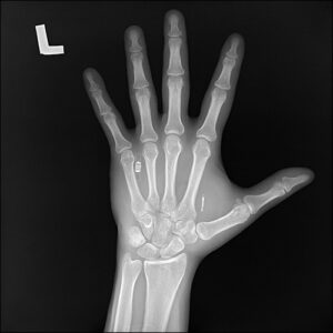 Walletmor's NFC tag can be embedded in a user's hand to enable credit card payments.